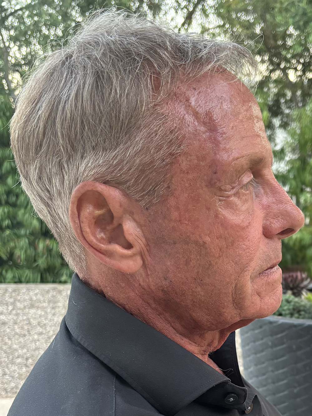 Kenneth J. Guoin's Healing Journey with Ophora Water